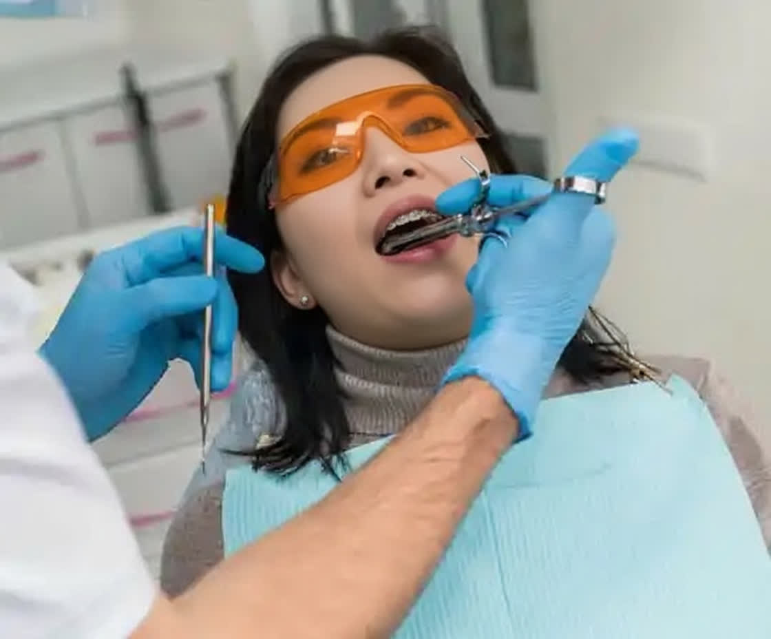 Local Anesthesia 西營盤牙醫
