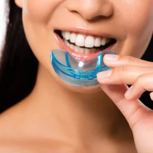 MouthGuard
