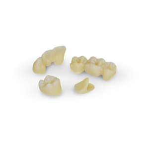 3M lava Esthetic all ceramic crown 全瓷冠 兆康牙醫