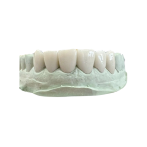 Temporary Resin Crown 彩虹牙醫
