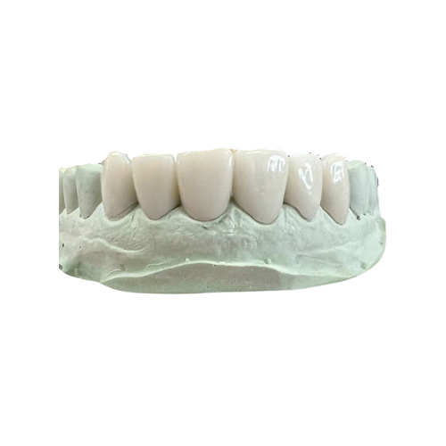 Temporary Resin Crown