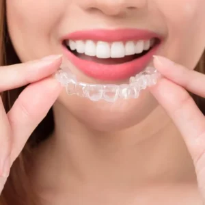 Invisalign Full 太子牙醫