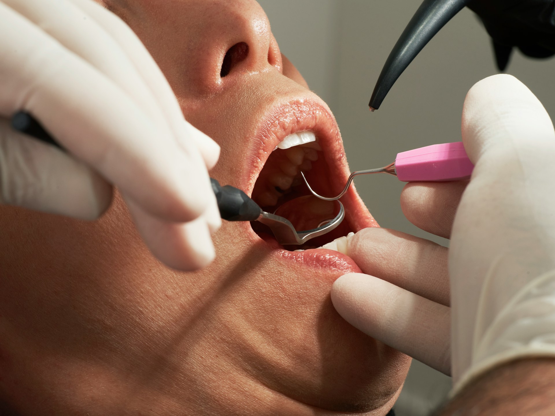 Dental Implants Art2