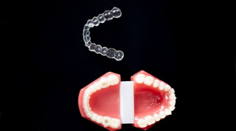 Understanding Mouthguards